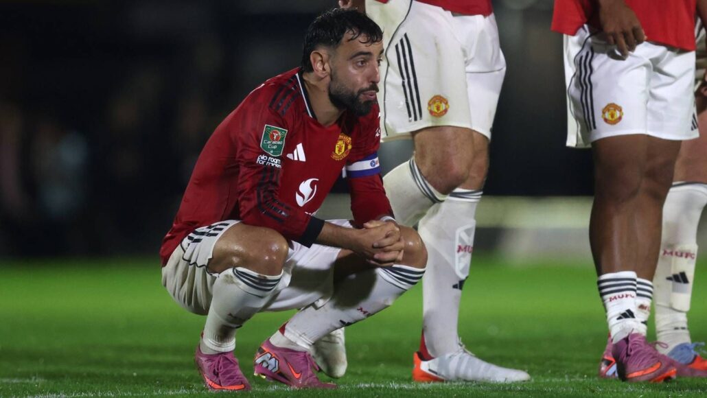 Bayer Leverkusen se burla de Manchester United tras su sorpresiva derrota