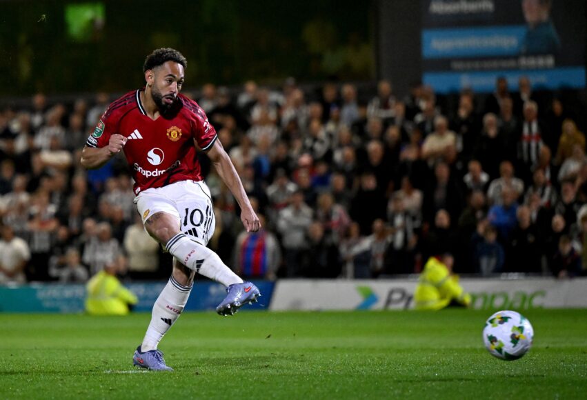 Cunha se lesiona ante Burnley: gran preocupación para el Man Utd y Amorim