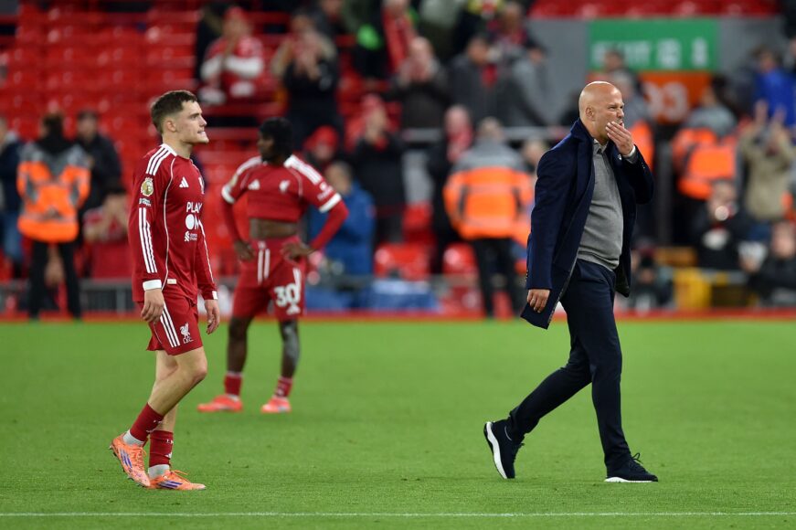 Selección extraña de Arne Slot en Liverpool causa críticas antes de la derrota ante Man Utd