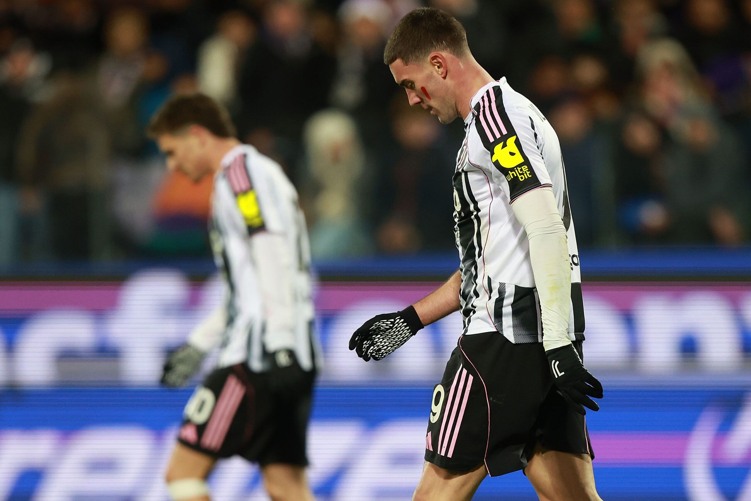 Juventus se prepara para desafíos en la Champions League por condiciones difíciles