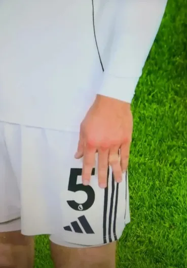Lesionado estrella de Fulham se recupera en el campo tras brutal accidente